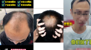 驳回原因示例： 请勿出现丑陋的影响用户体验的元素，需重新设计广告，如【视频中展现秃顶、脱发脱毛形象】，请修改