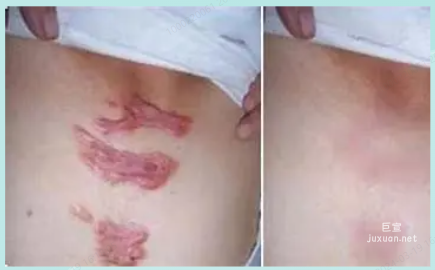 OPPO广告素材不美观