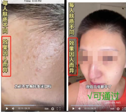 小红书广告标明“使用效果因人而异”