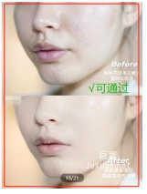 小红书广告化妆品使用效果