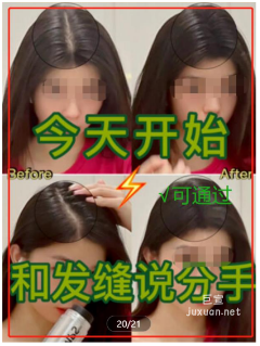 小红书发际线粉广告效果图